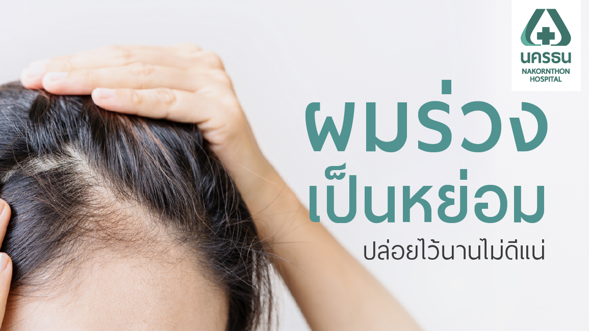 ผมร่วงเป็นหย่อม หมดความมั่นใจ ทำอย่างไรดี?